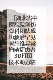 湖北省中医院院创伤骨科团队成功救治罕见骨纤维异常增殖症患者 3D打印技术助力精准矫形手术